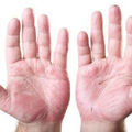秋季手掌脫皮是乾燥惹的禍？有可能預示著身體出現這4種疾病！