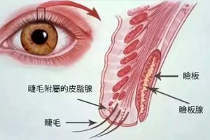 【養生】早起眼屎多？常吃這些護眼好食材，清火明目亮晶晶！