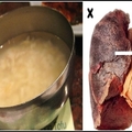  肺部清潔器！就靠這8種食物把你肺的毒素全吸光，為了家人看一眼吧！速傳！