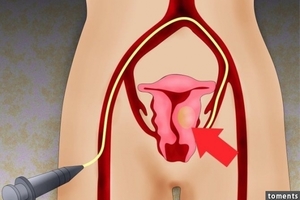 一位婦產科主任醫師警告：子宮裡的垃圾會殺死女人！尤其是「恩愛」時男人弄進去的...！竟有90%的人都不知道