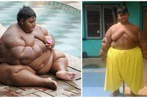 他才11歲體重就直逼「200公斤」，最後被政府「強制」瘦身，終於靠「這樣」成功減掉30公斤！