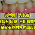 老中醫 告訴你: 牙結石、口臭 不用看醫生, 簡單又天然的方式學起來 ! 