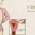 子宮腺肌症一直不治療會惡變嗎？