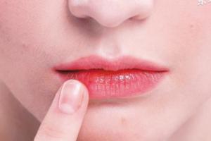 「唇部」保養方法，迷人嘴唇非你莫屬！