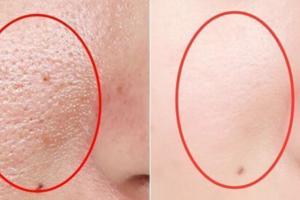 女人毛孔粗大不要擔心，給你支個小妙招，很快收縮毛孔提亮膚色