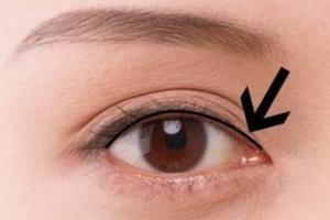 紋繡師初學者須知美瞳線施術的五大要點！