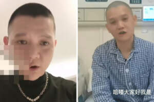                         36歲男歌手驚傳病逝！癌症3度復發「才切左臉又長腫塊」　最後身影曝光「苦求珍惜生命」：千萬別僥倖                    