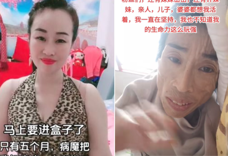 湘妹子生病前後的對比令人心疼。(圖/翻攝自「努力堅強的湘妹子阿妹」抖音) 湘妹子生病前後的對比令人心疼。(圖/翻攝自「努力堅強的湘妹子阿妹」抖音)