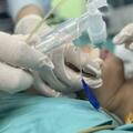 上海兒童醫學中心貴州醫院完成首例兒童單肺通氣主動脈縮窄糾治術