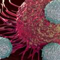 當一位癌症晚期病人遭遇新冠後，高燒可以「燙」死癌細胞嗎？