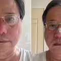 有夠慘！被蜂螫鼻樑曬照嘲「腫脹似豬八戒」 李來希：腫到人臉辨識失靈