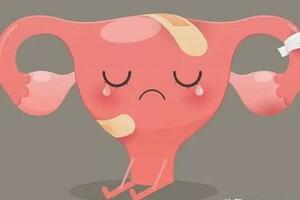 科普｜不能忽視的異常子宮出血