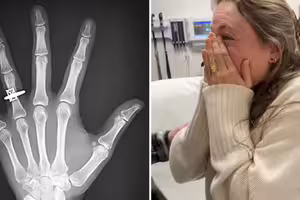 照X光驚見「無名指有鑽戒」 她感動落淚:我願意 照X光驚見「無名指有鑽戒」 她感動落淚:我願意