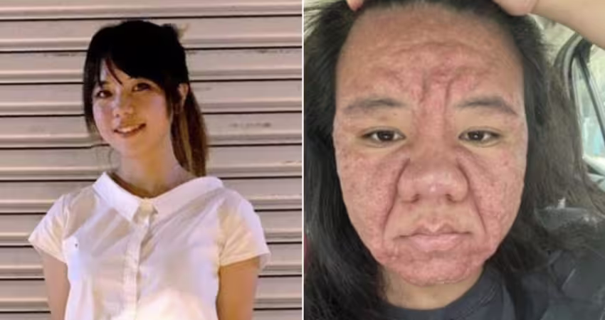 28歲女因懷孕「樣貌大變」！生產完近況曝