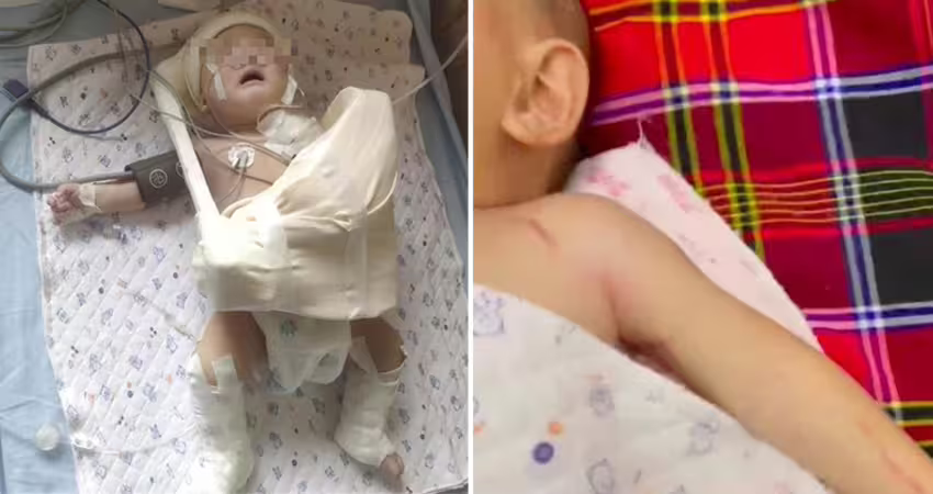 難產「扯斷男嬰手臂」媽崩潰 醫:不拉斷出不來