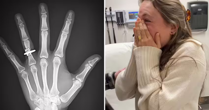 照X光驚見「無名指有鑽戒」　她感動落淚：我願意