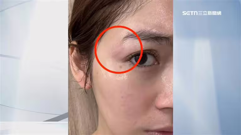 非首次出包?女星遭200度電棒捲燙傷臉 髮廊負評驚見「剪到耳朵流血」 非首次出包?女星遭200度電棒捲燙傷臉 髮廊負評驚見「剪到耳朵流血」