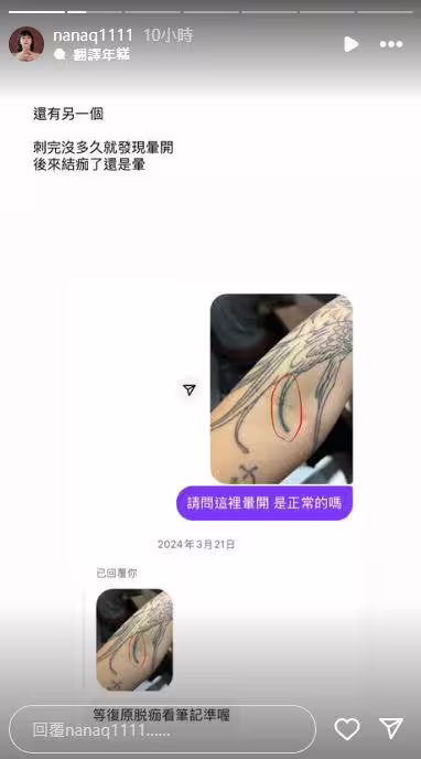 NanaQ指出,刺青還有出現暈開的問題。(圖/翻攝自NanaQ IG) NanaQ指出,刺青還有出現暈開的問題。(圖/翻攝自NanaQ IG)