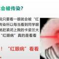 永州疾控丨看一眼就會被傳染？夏秋季「紅眼病」高發，如何預防？