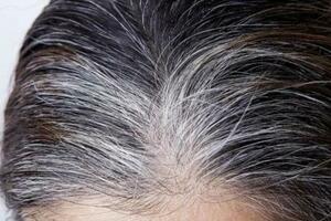 白髮突然增多是衰老的表現嗎？可能是身體缺這4種營養