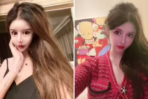 20歲女砸1700萬動刀上百次　「整型前清秀樣子曝光」她喊：還會繼續整