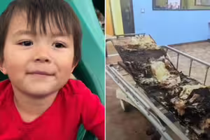 高壓氧艙突然爆炸!5歲兒遭活活燒死 媽目睹怒求償30億 高壓氧艙突然爆炸!5歲兒遭活活燒死 媽目睹怒求償30億