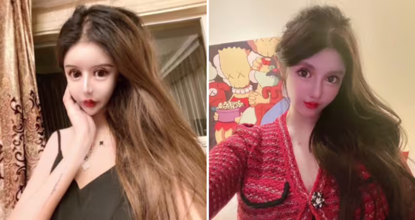 20歲女砸1700萬動刀上百次　「整型前清秀樣子曝光」她喊：還會繼續整