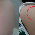 台灣人才有的「特殊印記」！女子手臂光滑「開始擔憂」網友：「是幸運的那10%」 