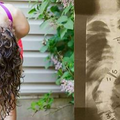 少女為了治療脊椎側彎選擇在15歲那年動刀矯正，無奈術後14年竟無法進食、長期臥床，直到現今才找出病因！ 