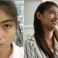 泰國這名18歲少女因被老師用馬克杯擊中頭部，導致左臉頰癱瘓，她卻笑著這麼說... 