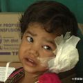 畫面駭人！印度4歲女童左耳劇痛 就醫後竟在耳內發現「這東西」網：看完我要吐了 