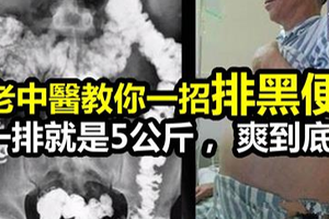 老中醫教你一招 「排黑便」 ！一次5公斤， 排便一次到底！