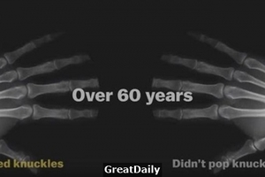 「折手指」到底有沒有壞處？外國專家花了60年時間「不停折手指」，竟得到......