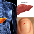 你的肝臟有沒有毒素，看這4個部位就知道了 !!