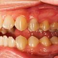 如果有牙結石口臭又超害怕看牙醫的話，這個「簡單又天然」的方式你一定要趕快收藏起來！