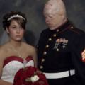 美國軍人在前線遇到自殺式襲擊，臉被炸爛！女友雖為愛嫁給他，但整場婚禮卻「沒笑過」…