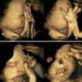 孕婦做彩色超音波，胎兒卻不停做鬼臉！她誇孩子是天才，醫生卻冷回：「打掉吧」！