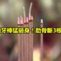 乩童狼牙棒猛砸身！肋骨斷3根浴血亡