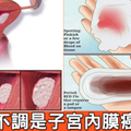 「月經不順」非小事！「六大症狀」恐是子宮內膜癌變前兆，這種出血狀況最危險