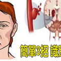 「中風」有跡可循？簡單「3步驟」識別「腦中風」，關鍵時刻能救命！