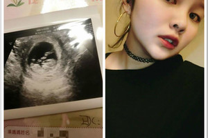 坐博愛座被趕！年輕孕婦遭正義魔人嗆不要臉 忍痛站起害下體冒血急安胎