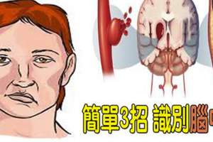 「中風」有跡可循？簡單「3步驟」識別「腦中風」，關鍵時刻能救命！