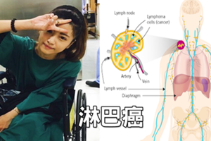 25歲新手媽媽挺過「七次化療」感動萬人！秒懂「淋巴癌」六大警訊，病發3個月內最致命