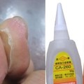 不小心被快乾黏住手指怎麼辦？有了這些方法不用再用美工刀硬掰了！