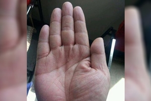 如果你手上有「這條特殊掌紋」就神了！「兩手都有」一生大富大貴，左右手若有也都「命超好」啊！