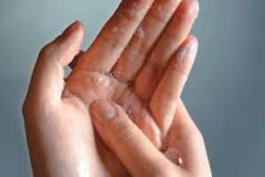 對抗超級細菌／錯誤的洗手方式愈洗愈髒！抗菌3大招