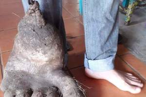 巴西出現《巨人腳馬鈴薯》這是奇行種的腳吧