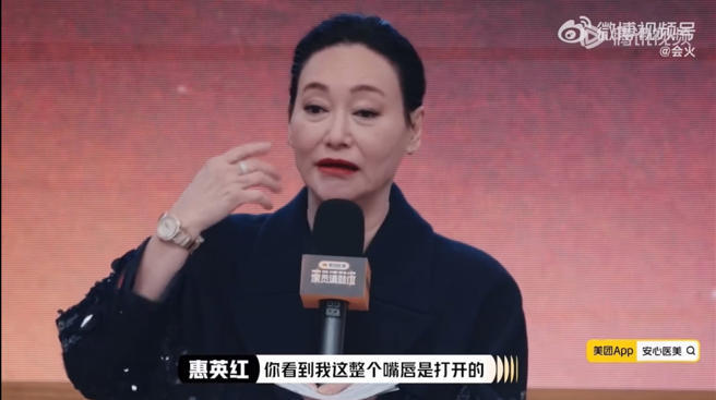 惠英紅說到,包含嘴唇、眼角、顴骨等多個部位通通都受傷挨過針。(圖/微博) 惠英紅說到,包含嘴唇、眼角、顴骨等多個部位通通都受傷挨過針。(圖/微博)