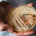 致命真菌正以「驚人的速度」在美國傳播，死亡率高但健康人群感染風險低