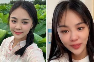 抓包老公出軌離婚　千萬網紅「秒整形」喊：我要讓他後悔！新面貌曝光網看傻
